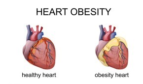 heart-obesity