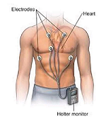 holter-monitoring